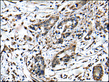 Anti-ZFP36 affinity isolated antibody