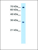 Anti-FCGRT affinity isolated antibody