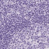 Anti-LGSN antibody produced in rabbit Prestige Antibodies&#174; Powered by Atlas Antibodies, affinity isolated antibody