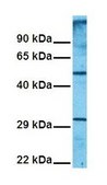 Anti-SLC1A5 IgG fraction of antiserum