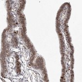 Anti-MSH6 antibody produced in rabbit Prestige Antibodies&#174; Powered by Atlas Antibodies, affinity isolated antibody, buffered aqueous glycerol solution, ab1