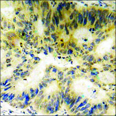 Anti-phospho-Stathmin 1 (pSer24) antibody produced in rabbit affinity isolated antibody