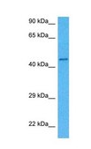 Anti-MITF antibody produced in rabbit affinity isolated antibody