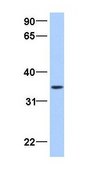 Anti-ATG5 antibody produced in rabbit affinity isolated antibody