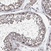 Anti-PPP2R5D antibody produced in rabbit Prestige Antibodies&#174; Powered by Atlas Antibodies, affinity isolated antibody, buffered aqueous glycerol solution, ab1