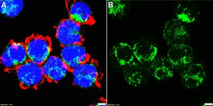 Anti-Interleukin-21 Antibody, clone 2B13 ZooMAb&#174; Rabbit Monoclonal recombinant, expressed in HEK 293 cells