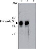 Anti-Pentraxin 3 antibody, Mouse monoclonal clone PTX3-5, purified from hybridoma cell culture
