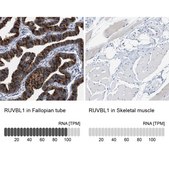 Anti-RUVBL1 antibody produced in rabbit Prestige Antibodies&#174; Powered by Atlas Antibodies, affinity isolated antibody, buffered aqueous glycerol solution