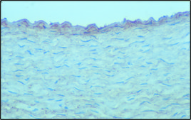 Monoclonal Anti-Chondroitin Sulfate antibody produced in mouse clone CS-56, ascites fluid