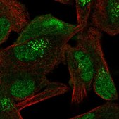 Anti-CAND1 antibody produced in rabbit Prestige Antibodies&#174; Powered by Atlas Antibodies, affinity isolated antibody