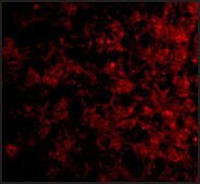 Anti-TSLP Receptor (ab1) antibody produced in rabbit affinity isolated antibody, buffered aqueous solution