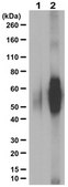 Anti-Modified Citrulline Antibody, clone C4 clone C4, from human(Recombinant)