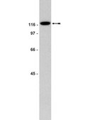 Anti-FAK Antibody, clone 4.47 clone 4.47, Upstate&#174;, from mouse