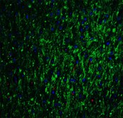 Anti-GLS2 antibody produced in rabbit affinity isolated antibody