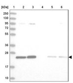 Anti-TPT1 antibody produced in rabbit Prestige Antibodies&#174; Powered by Atlas Antibodies, affinity isolated antibody, buffered aqueous glycerol solution