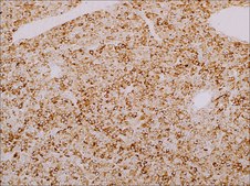 Inhibin, alpha (MRQ-63) Rabbit Monoclonal Antibody