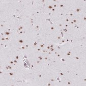 Anti-SRSF7 antibody produced in rabbit Prestige Antibodies&#174; Powered by Atlas Antibodies, affinity isolated antibody, buffered aqueous glycerol solution