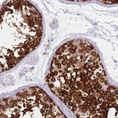 Anti-DDX4 antibody produced in rabbit Prestige Antibodies&#174; Powered by Atlas Antibodies, affinity isolated antibody, buffered aqueous glycerol solution