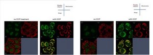 Anti-phospho-Ubiquitin (Ser65) from rabbit, purified by affinity chromatography