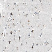 Anti-PSMB4 antibody produced in rabbit Prestige Antibodies&#174; Powered by Atlas Antibodies, affinity isolated antibody, buffered aqueous glycerol solution