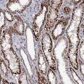 Anti-MGLL antibody produced in rabbit Prestige Antibodies&#174; Powered by Atlas Antibodies, affinity isolated antibody, buffered aqueous glycerol solution