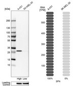 Anti-SFN antibody produced in rabbit Prestige Antibodies&#174; Powered by Atlas Antibodies, affinity isolated antibody, buffered aqueous glycerol solution