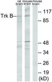 Anti-TRK B antibody produced in rabbit affinity isolated antibody