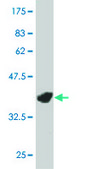 ANTI-LIMK1 antibody produced in mouse clone 2E9, purified immunoglobulin, buffered aqueous solution