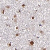 Anti-TERF2 antibody produced in rabbit Prestige Antibodies&#174; Powered by Atlas Antibodies, affinity isolated antibody, buffered aqueous glycerol solution