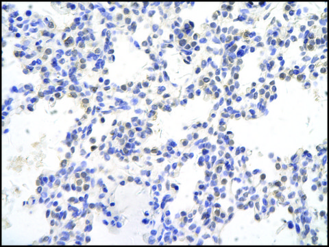 Anti-SMAD4 antibody produced in rabbit affinity isolated antibody