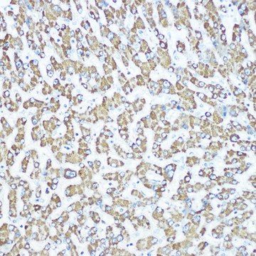 Anti-CPS1 antibody produced in rabbit