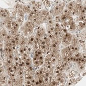 Anti-LTA4H antibody produced in rabbit Prestige Antibodies&#174; Powered by Atlas Antibodies, affinity isolated antibody, buffered aqueous glycerol solution, Ab1