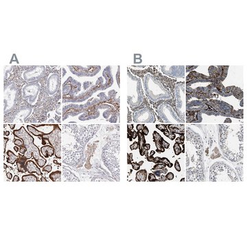 Anti-TGM2 antibody produced in rabbit Prestige Antibodies&#174; Powered by Atlas Antibodies, affinity isolated antibody, buffered aqueous glycerol solution