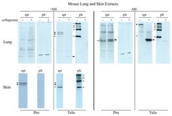 Anti-Pro-Collagen Type I, A1/COL1A1 from rabbit, purified by affinity chromatography
