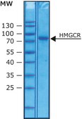 3-Hydroxy-3-methylglutaryl-CoA reductase human solution