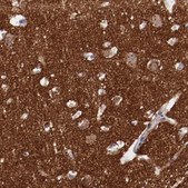 Anti-SYP antibody produced in rabbit Prestige Antibodies&#174; Powered by Atlas Antibodies, affinity isolated antibody, buffered aqueous glycerol solution