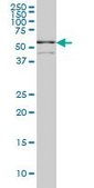 Monoclonal Anti-TCF7L2 antibody produced in mouse clone 3D7, purified immunoglobulin, buffered aqueous solution
