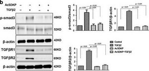 Anti-TGF &#946; Receptor I antibody produced in rabbit affinity isolated antibody