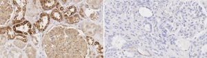 Anti-TRPM7 Antibody, clone 1B7 ZooMAb&#174; Rabbit Monoclonal recombinant, expressed in HEK 293 cells