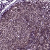 Anti-GOT1 antibody produced in rabbit Prestige Antibodies&#174; Powered by Atlas Antibodies, affinity isolated antibody