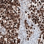 Monoclonal Anti-CHEK2 antibody produced in mouse Prestige Antibodies&#174; Powered by Atlas Antibodies, clone CL9440, purified immunoglobulin, buffered aqueous glycerol solution