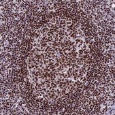 Anti-PARP1 antibody produced in rabbit Prestige Antibodies&#174; Powered by Atlas Antibodies, affinity isolated antibody, buffered aqueous glycerol solution