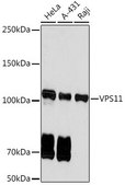 Anti-VPS11 antibody produced in rabbit