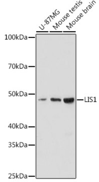 Anti-LIS1 Antibody, clone 9O6X3, Rabbit Monoclonal