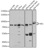 Anti-NF2 antibody produced in rabbit