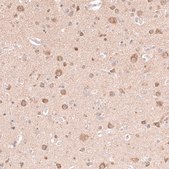 Anti-NELL1 antibody produced in rabbit Prestige Antibodies&#174; Powered by Atlas Antibodies, affinity isolated antibody, buffered aqueous glycerol solution