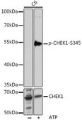 Anti-Phospho-CHEK1-S345 antibody produced in rabbit