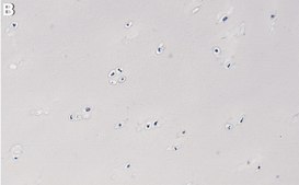 Anti-Collagen Type II Antibody, clone 1K11 ZooMAb&#174; Rabbit Monoclonal recombinant, expressed in HEK 293 cells