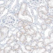 Anti-SLC22A8 antibody produced in rabbit Prestige Antibodies&#174; Powered by Atlas Antibodies, affinity isolated antibody, buffered aqueous glycerol solution