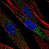 Anti-OGN antibody produced in rabbit Prestige Antibodies&#174; Powered by Atlas Antibodies, affinity isolated antibody, buffered aqueous glycerol solution